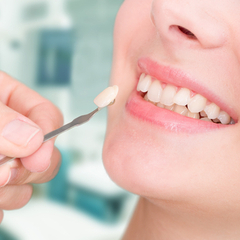 Dental Crown Treatment in Istanbul