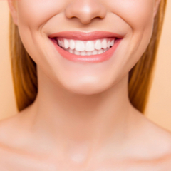 Hollywood Smile with Veneers in Istanbul