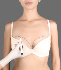 Breast Lift in Istanbul