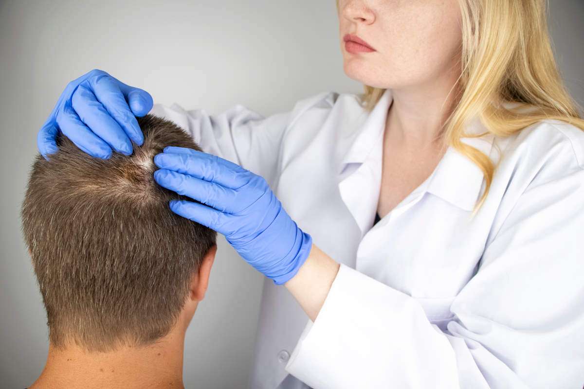 Things you should know before your Hair Transplant in Turkey